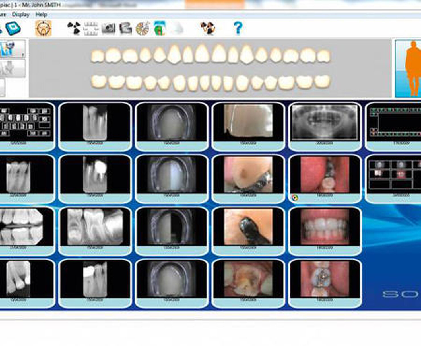 Software SOPRO Imaging