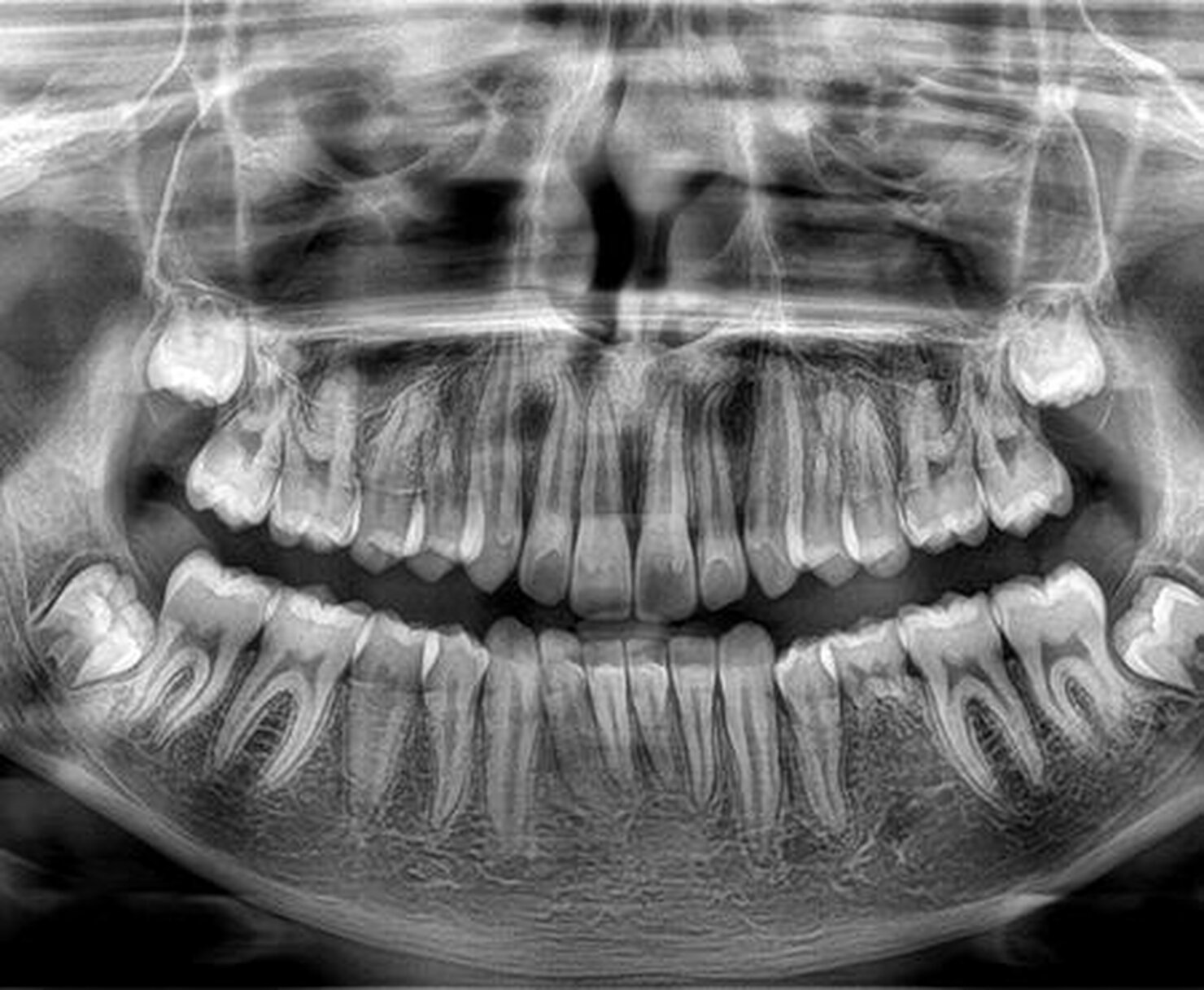 Immagine panoramiche nitide