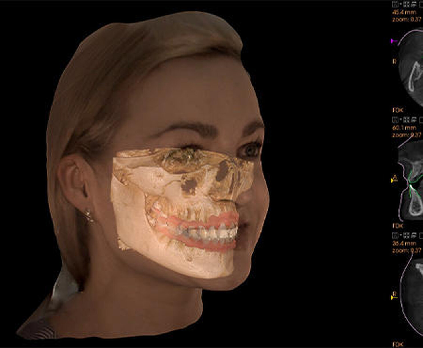 CS Face Scan