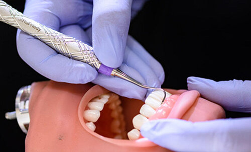 Disordini muscoloscheletrici ed ergonomia dello scaler