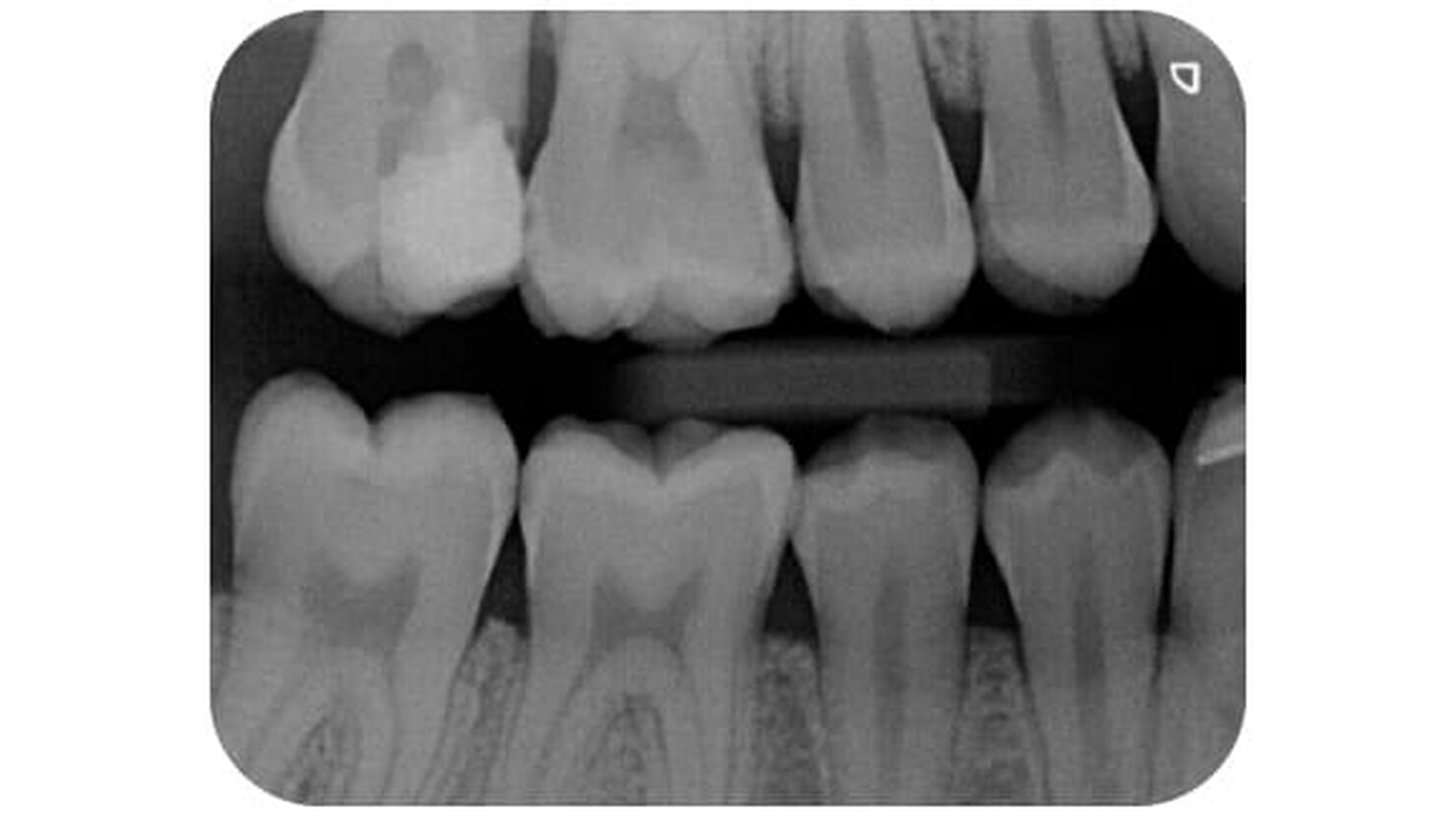 Elevata qualit&agrave; d'immagine