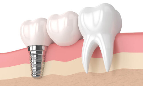 Stabilit&agrave; primaria