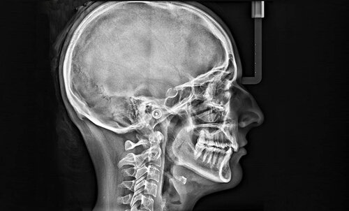 diagnostica digitale