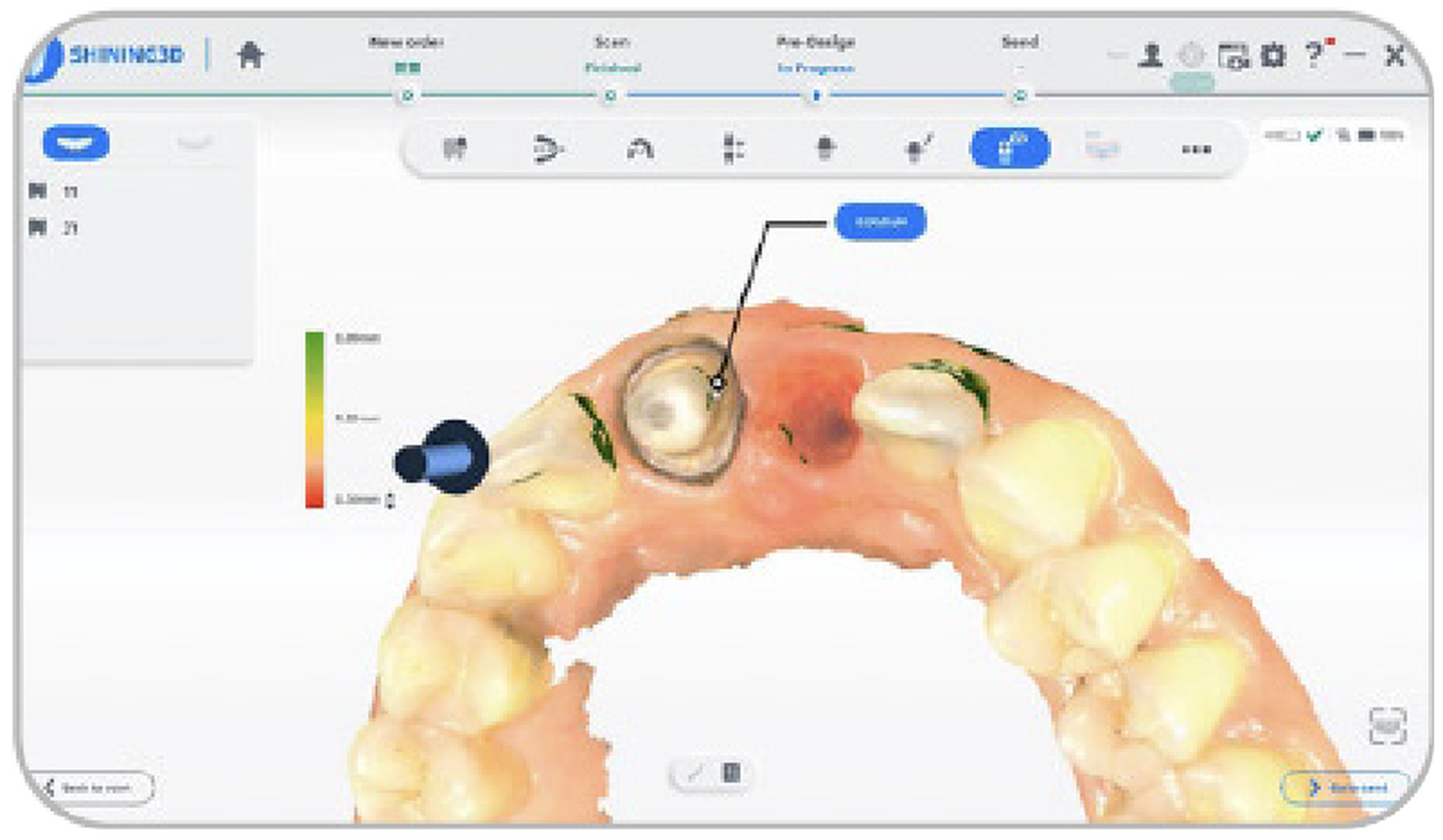 Controllo sottosquadri 