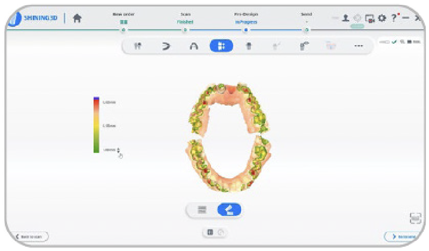 Controllo occlusione 