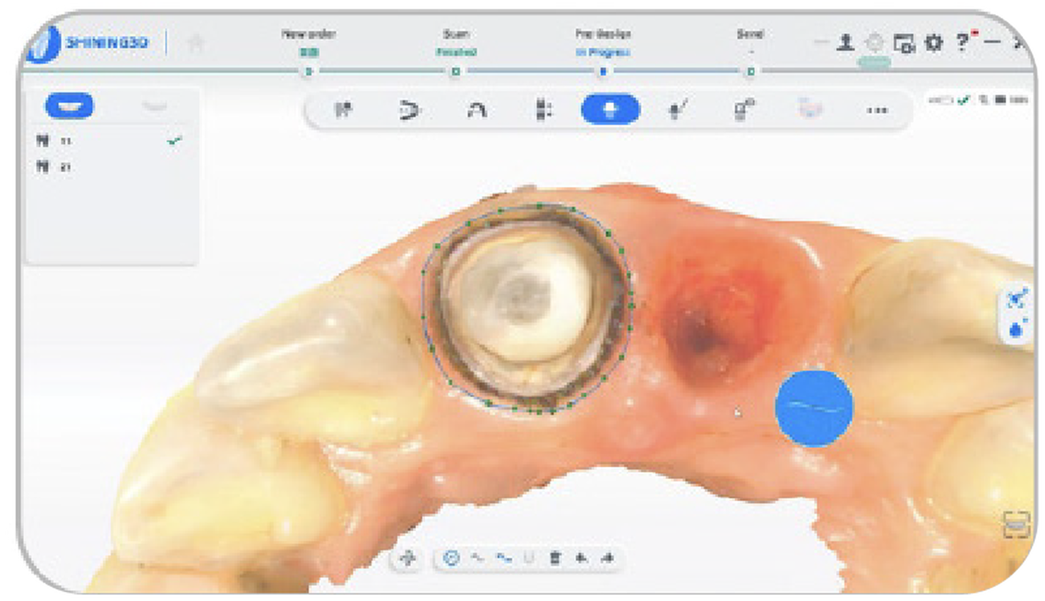 Estrapolazione della linea di margine