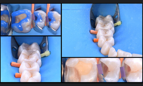 matrici conservativa