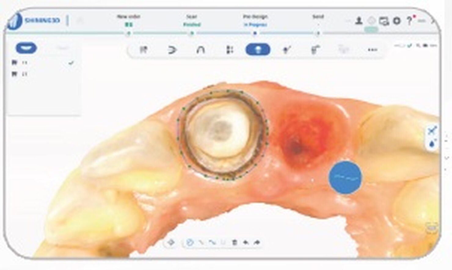 Auto estrazione della linea di preparazione