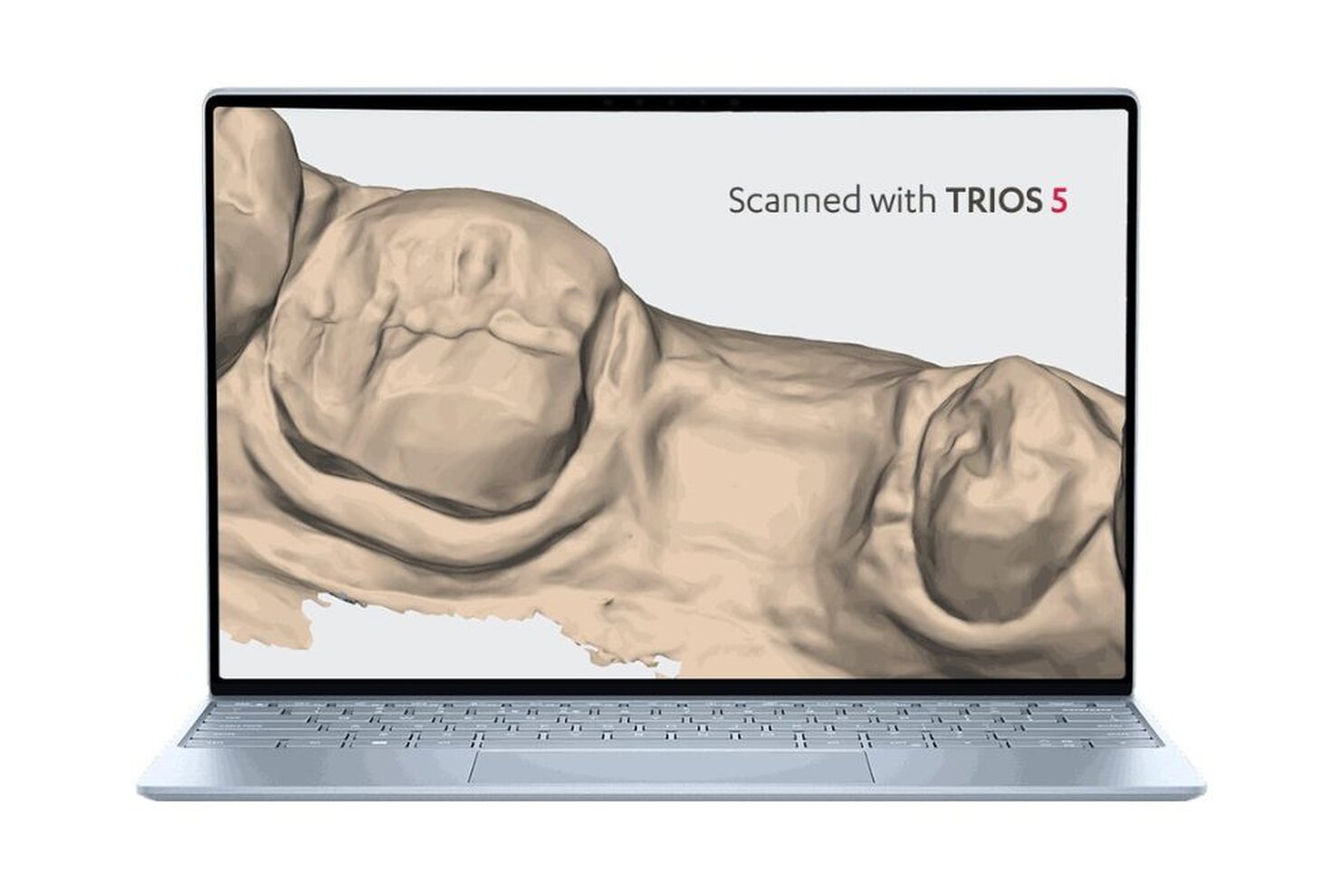 Nuova tecnologia hyperspectral