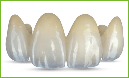 Ossido di zirconio nella tecnologia dentale: tra forza innovativa e applicazione pratica