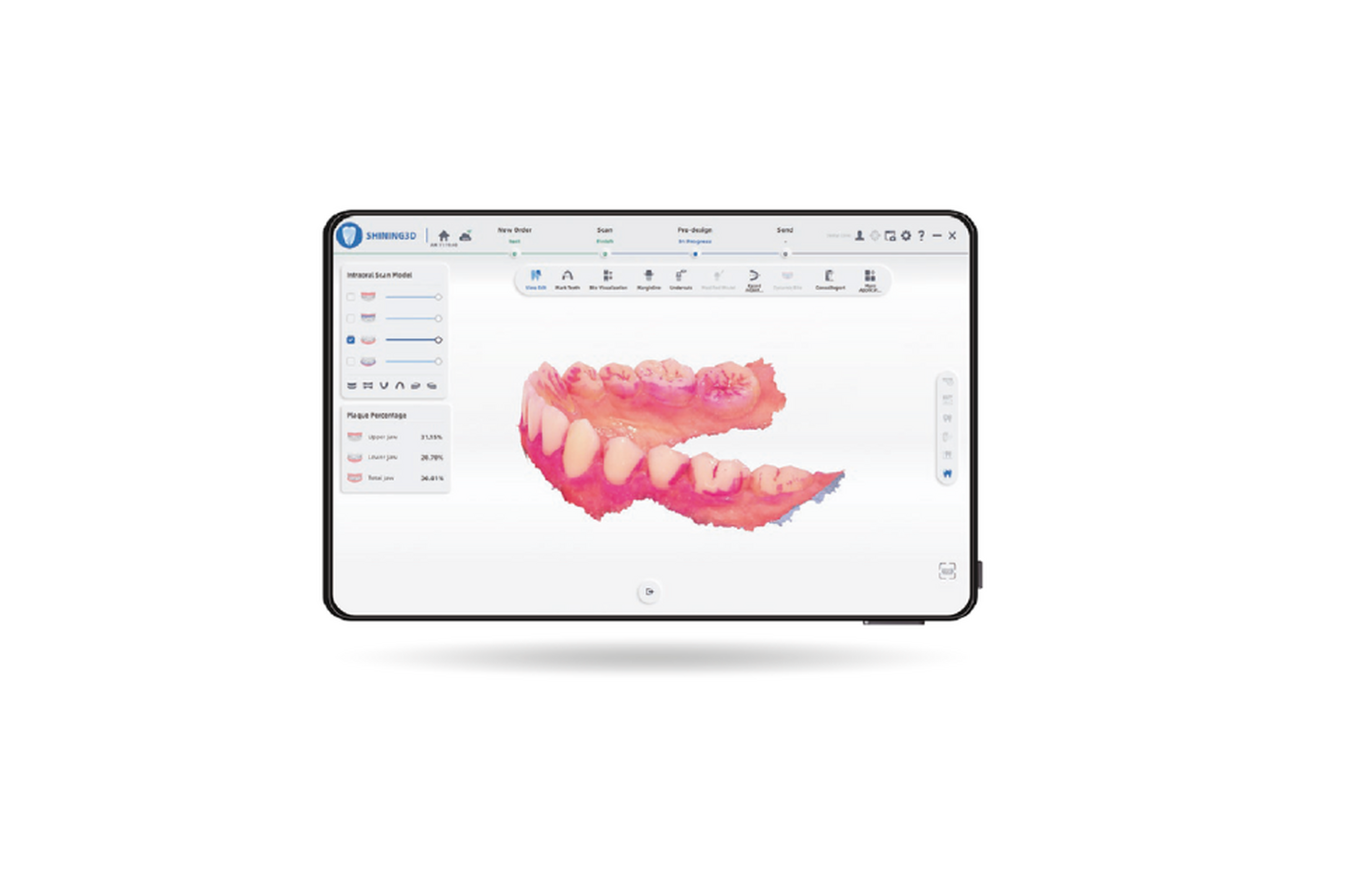 SCANSIONE E ANALISI DELLA PLACCA