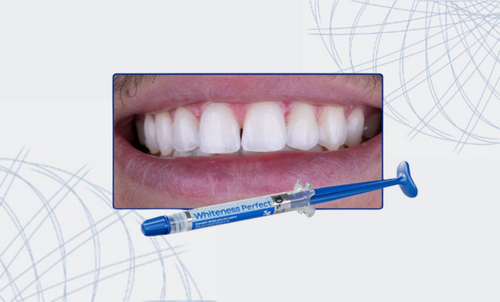 Sbiancamento nella tecnica domestica con Whiteness Perfect 10%