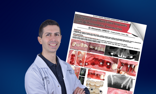 Impianti Pterigoidei Inclinati con Connessione Bi-Conometrica