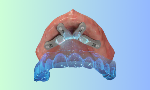 ioConnect&trade;: la scansione che trasforma uno svantaggio in precisione