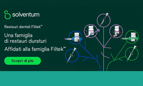 Risultato prima e dopo per la chiusura estetica di diastemi