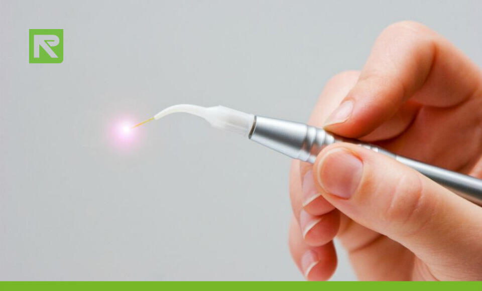 laser odontoiatrico tecnologia