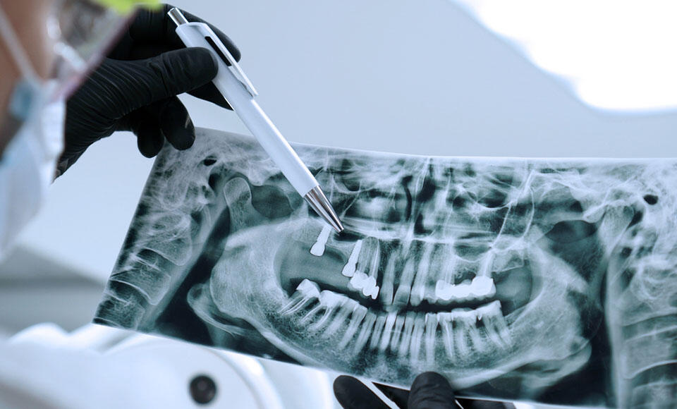 Livelli Diagnostici di Riferimento