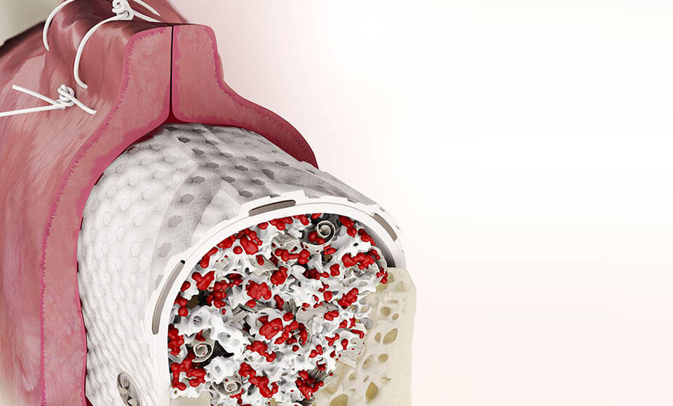 chirurgia rigenerativa