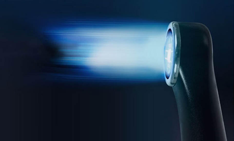 Fotopolimerizzazione 