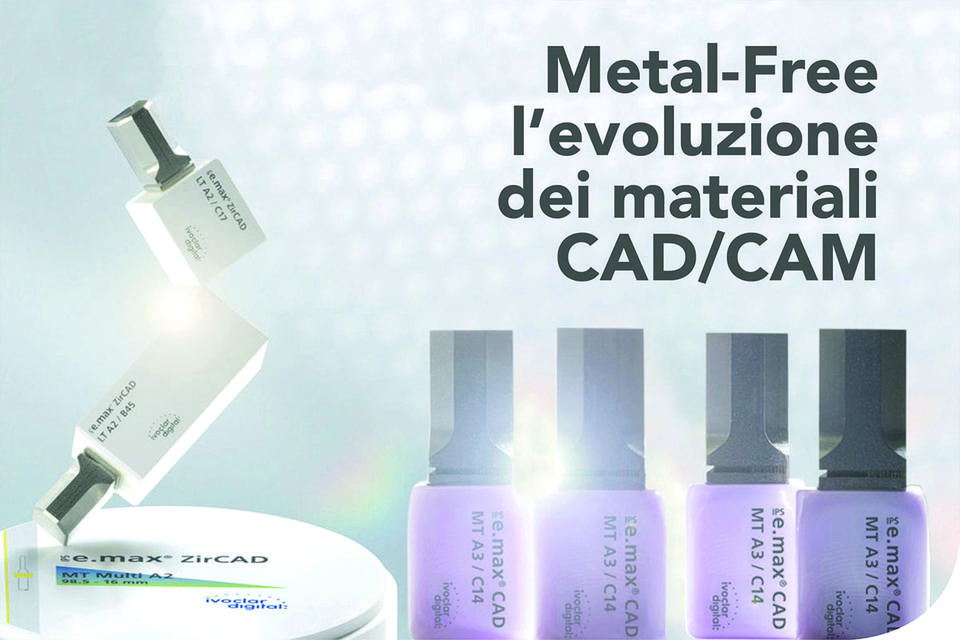 L&rsquo;evoluzione dei materiali cad/cam per impianti dentali