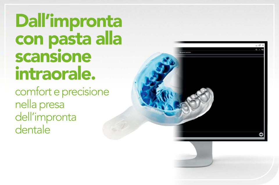 L&rsquo;impronta dentale elimina il manufatto e diventa digitale