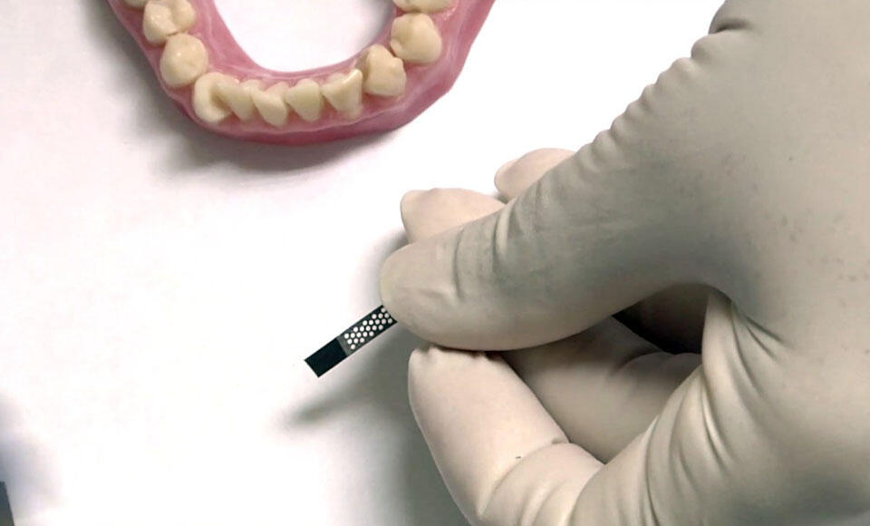 spazio interprossimale