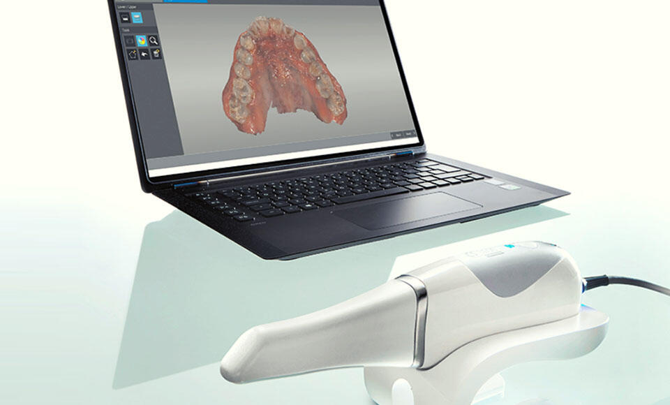 scanner intraorale