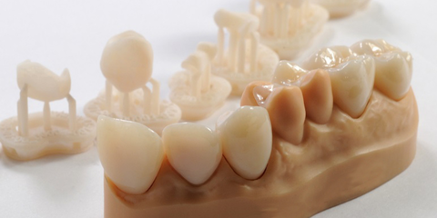 Aperiprint - dalla scansione alla stampa 3D