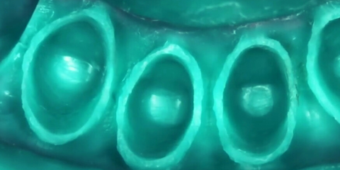 Guida alla soluzione degli errori nell&lsquo;impronta attraverso procedure semplificate 