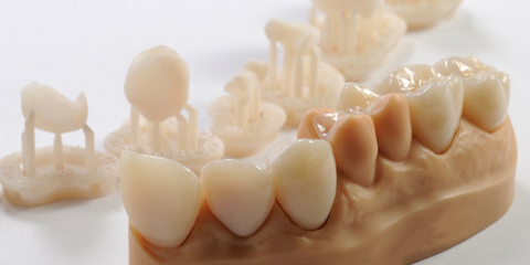 Dalla scansione intraorale alla stampa 3D