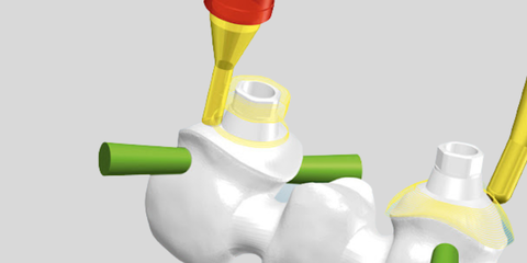 Hyperdent: full immersion