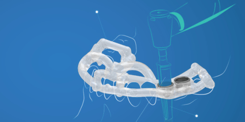 La chirurgia computer guidata dalla A alla Z