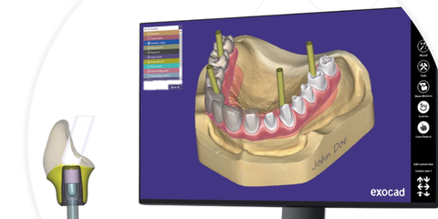 Master Gestione delle grosse riabilitazioni I-II livello 