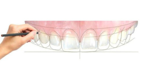 La riabilitazione del gruppo anteriore nell'era digitale