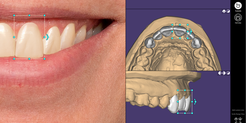 La riabilitazione del gruppo anteriore nell'era digitale