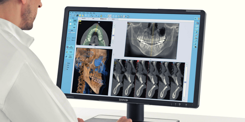 3D tra le dita - percorso pratico di avvicinamento alla radiologia Cone Beam 3D