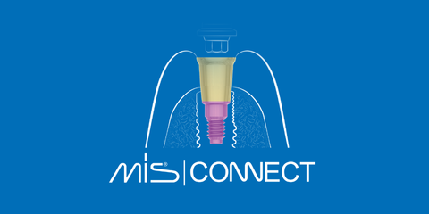 CONNECT Abutment: il nuovo approccio protesico per un'implantologia moderna
