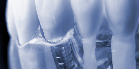 Serate culturali bergamasche: approfondimenti clinici