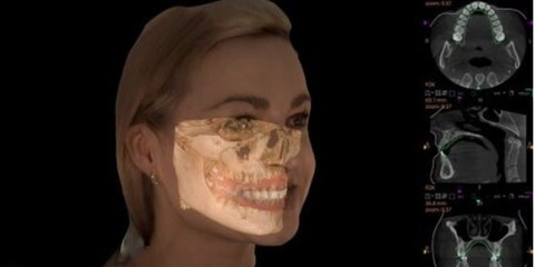 Corso avanzato Cone Beam 3D - Trophy