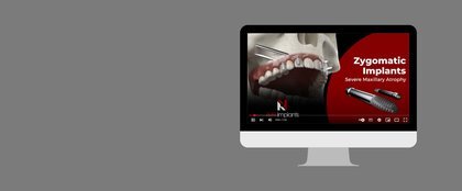 Video Zygomatic 