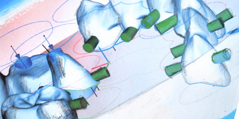 Ottimizza il tuo flusso di lavoro CAD/CAM