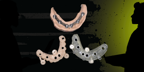 La comunicazione digitale medico tecnica durante la realizzazione di un carico immediato