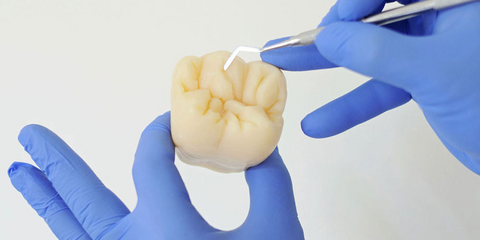 Occlusal Design nei restauri diretti del settore posteriore: dal posizionamento dei contatti all'anatomia occlusale funzionale 