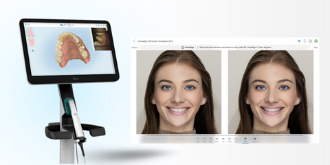 Open Day Itero Invisalign