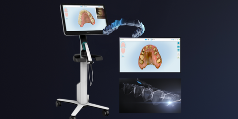 Il piano di trattamento integrato orto-restaurativo nella riabilitazione estetica con faccette