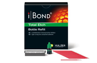 iBond Total Etch Kulzer