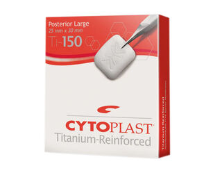 Cytoplast TI-150 De Ore