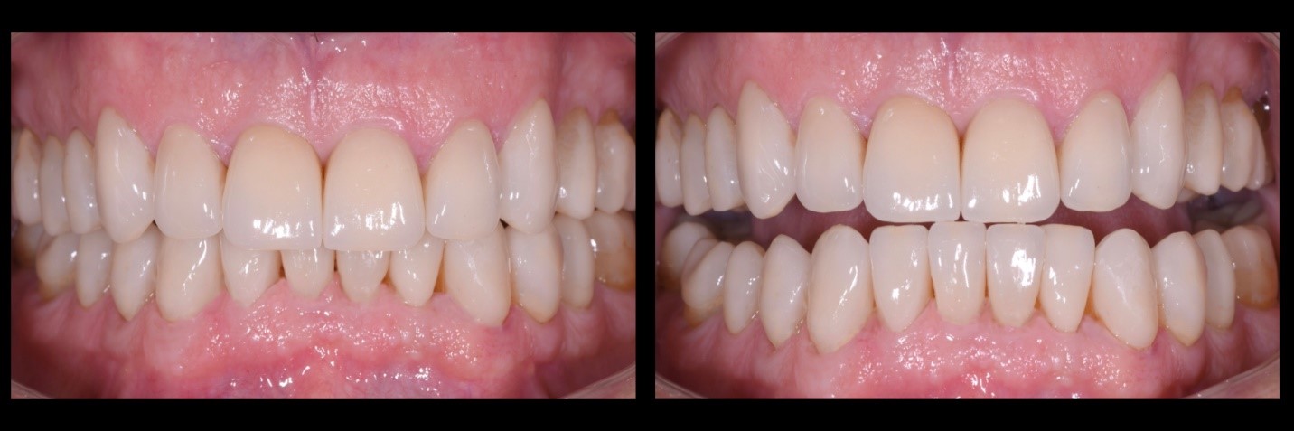 garrison-roberto-turrini