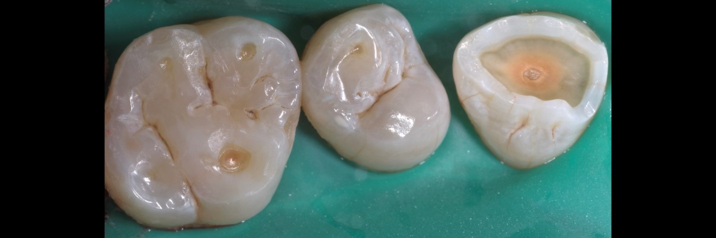 garrison-roberto-turrini