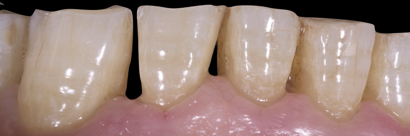 garrison-roberto-turrini